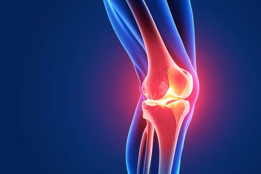 Effective Treatment for Bone on Bone Knee: Natural Relief and Medical Options